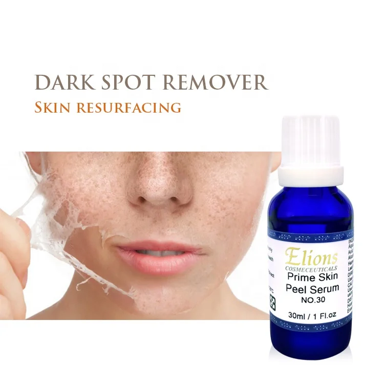 Prime Skin Peel Acid No. 30 Anti-Aging Liquid Peels Face Body Pigmentation Corrector Whitening Wrinkle Remover Stretch Mark