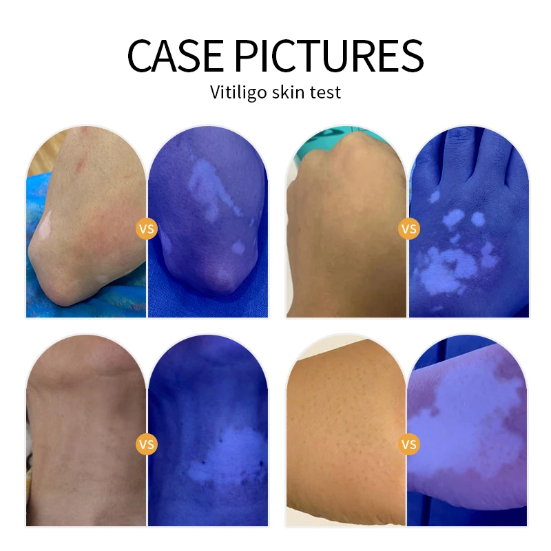 Skin Analyzer Machine Skin Examination Beauty Test Facial Magnifying Analysis