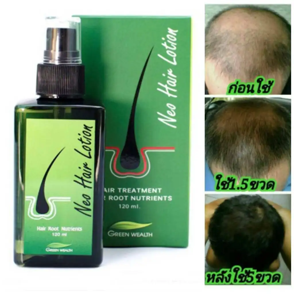 Neo Hair Lotion Hair Serum Hair Loss Genuine by Green Wealth Thailand