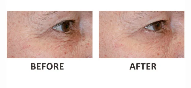 All Natural Cosmetics Made By Plant Stem Cells