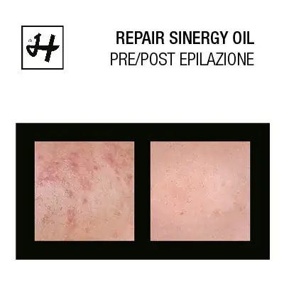 Natural Oil Prevents Skin Dehydration 11 Essential Oils Total Body Post Depilation Made in Italy After epilation oli