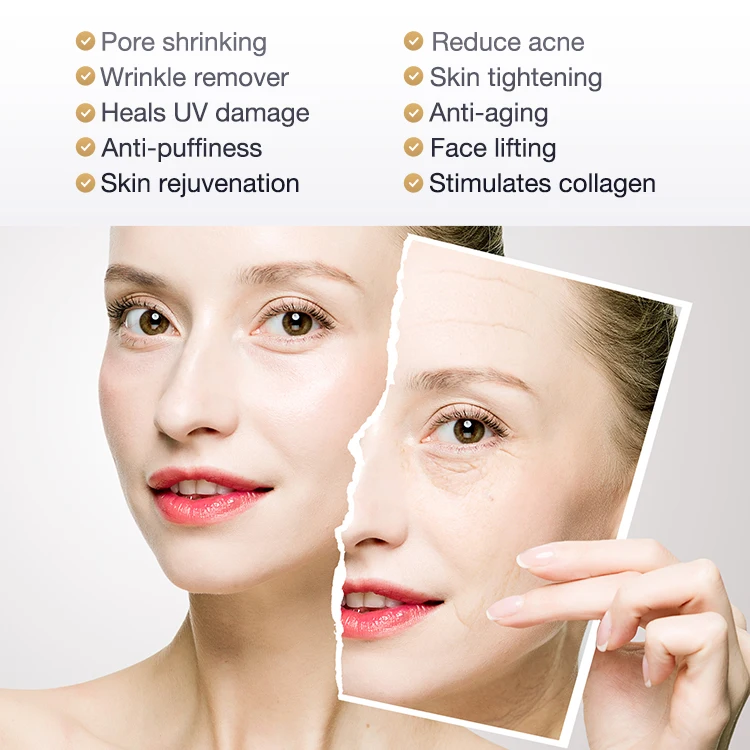 
CE and RoHs approved Munti function handheld Smart RF EMS MASS LED Facial skin care Device Facial Lifting Device 