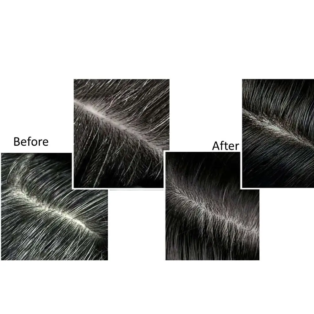 
Private label hair growth serum for Anti Dandruff serum 