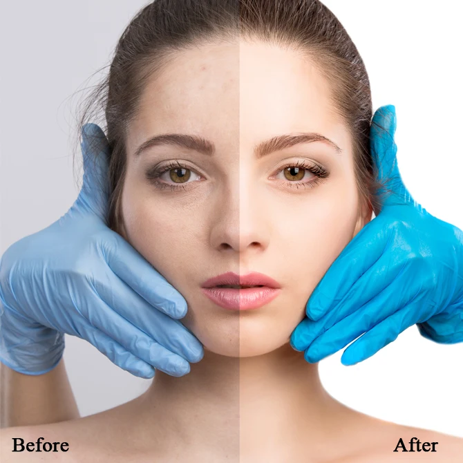 ODM OEM factory private label Brightenyl face pigmentation dark spot removing black skin bleaching lightening whitening cream