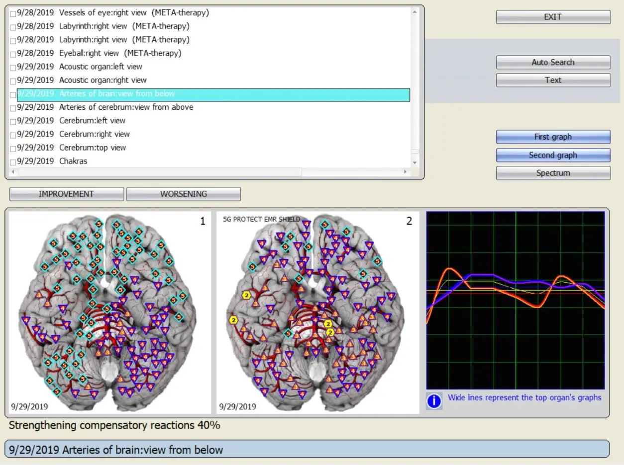 Radiation Emf Protection Anti Radiation Chip for Laptop Buy at Wholesale Price
