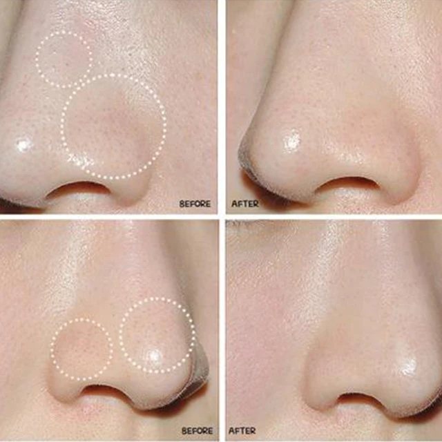 
Holika Holika Pig Nose Strips Clear Black Head Private Label OEM ODM skincare Korean Cosmetics wholesale skin care Pore firming 