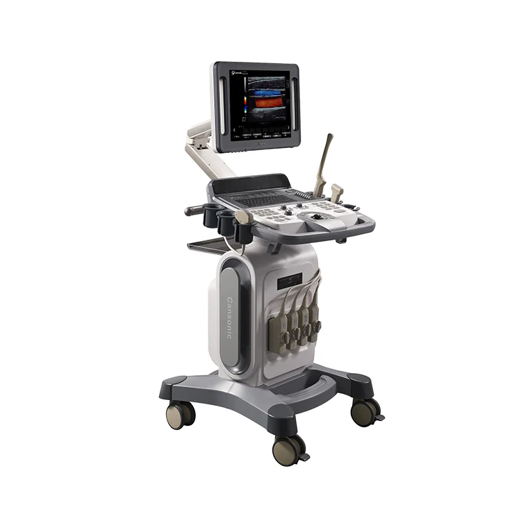 DSC Color Doppler 1700A Color Doppler System Sonoscape E1Exp Ultrasonido Doppler A Color Cansonic Medical Ultrasound Instruments