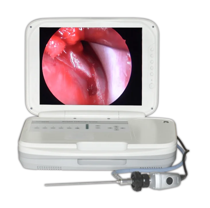 15 inch HD medical endoscope portable endoscope camera