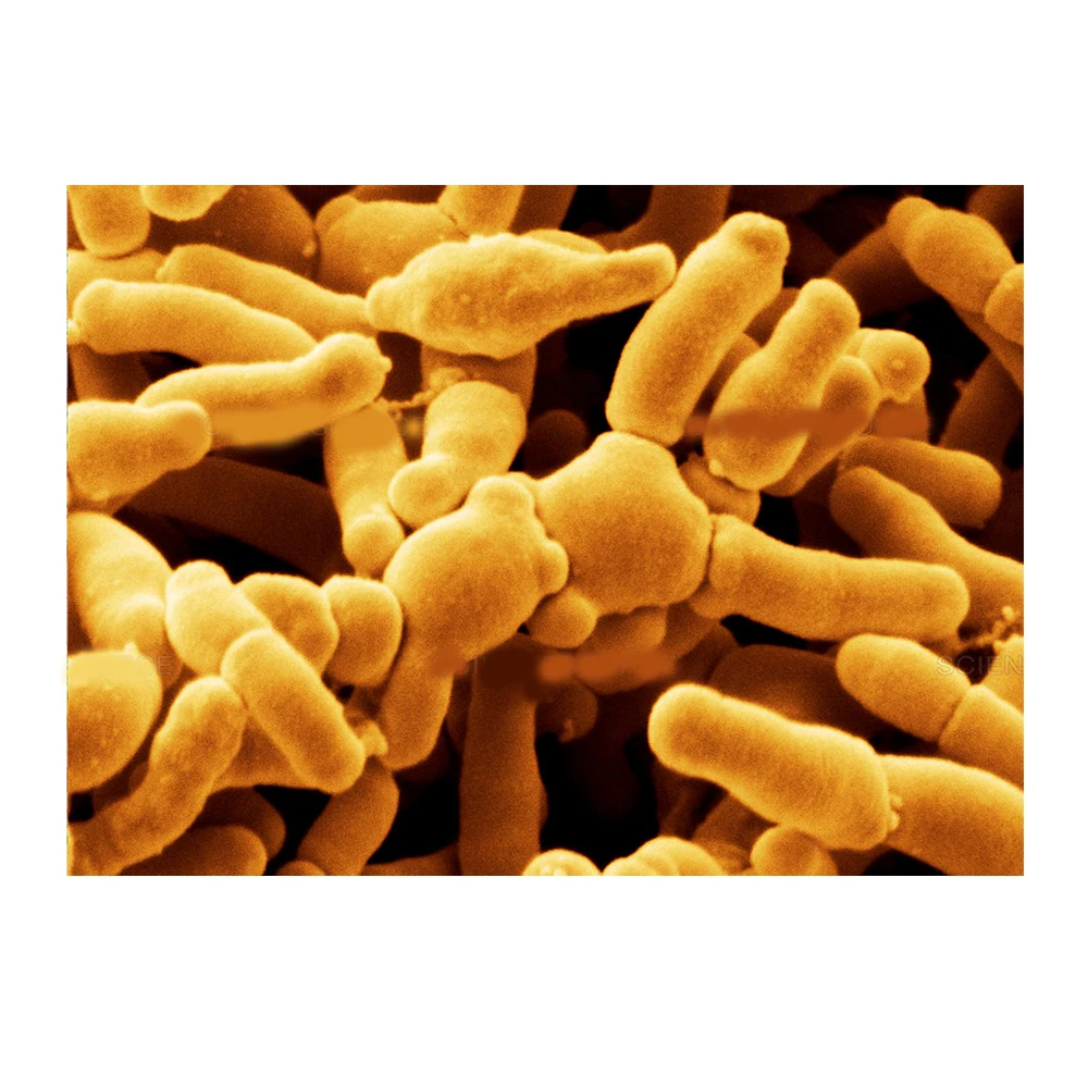 
Wholesale Price Natural Probiotics Bifidobacterium Breve Probiotics - Zealmax Biopharma 