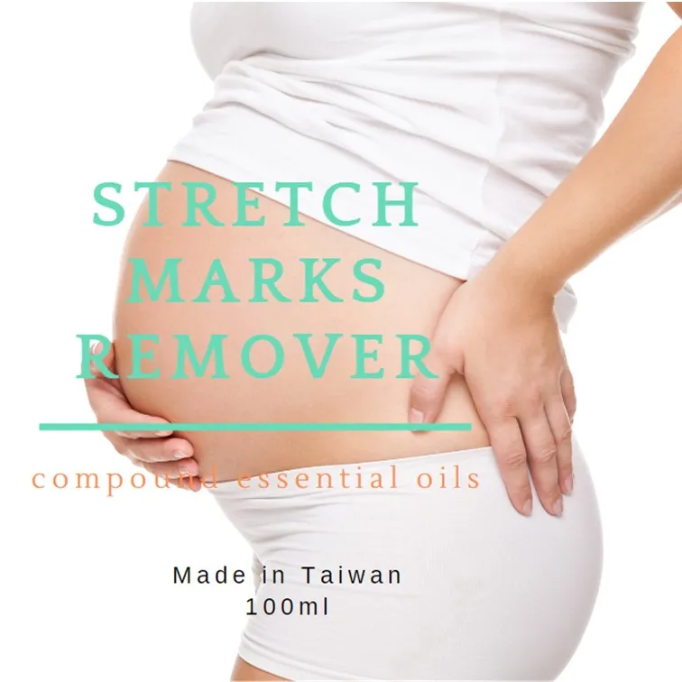 2021 best sell Ayurvedic essential oil compound of Stretch Mark Removal Maternity Slackline For Scars, Aging & Wrinkle skin, soo