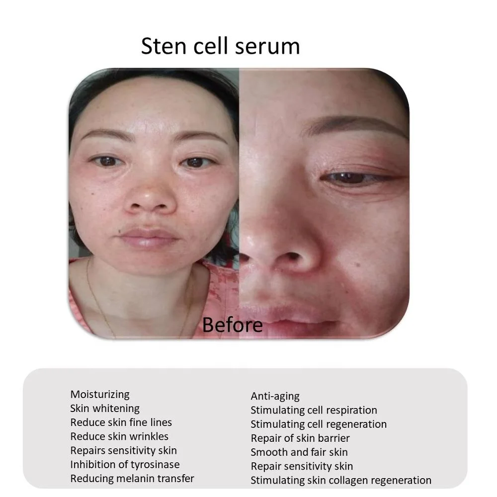
OEM Plant cell remove wrinkles anti aging Face Serum 
