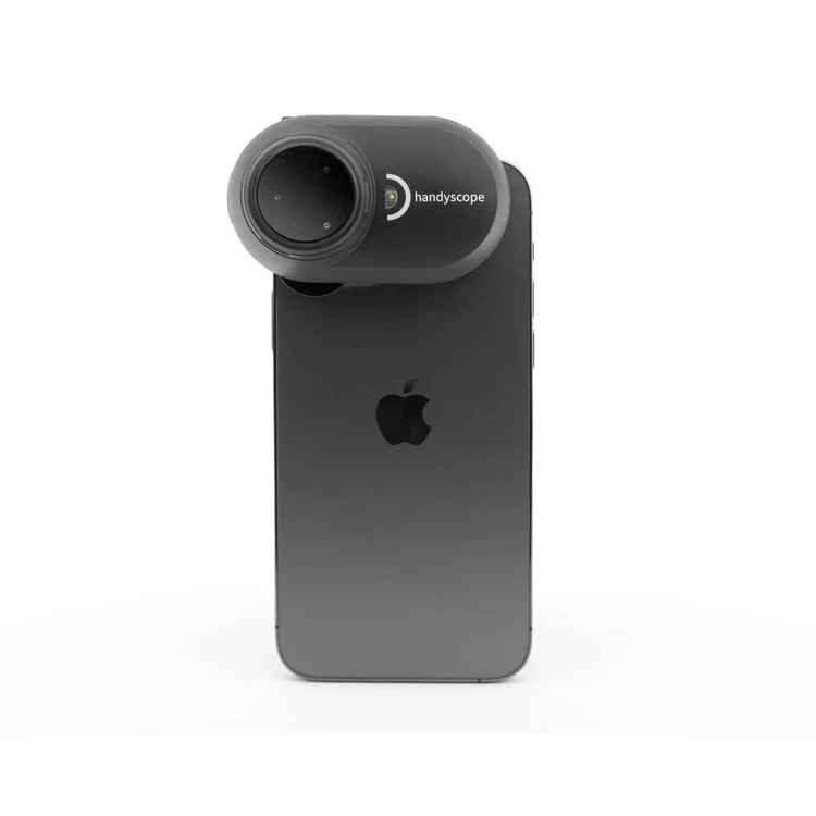 Ios dermatoscope FotoFinder brings together world-class experts into a single network hair analyzer