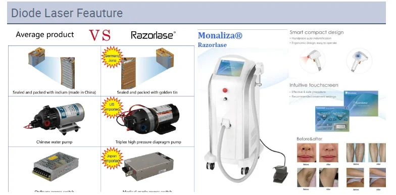 Лазерное удаление волос 3 в 1 755 808 1064 безболезненная Перманентная и полная длина волны