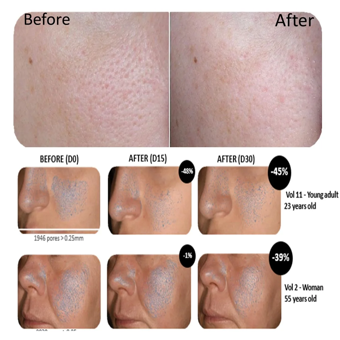 
Facial retinol anti aging Mask for skin care Moisturizing mask 