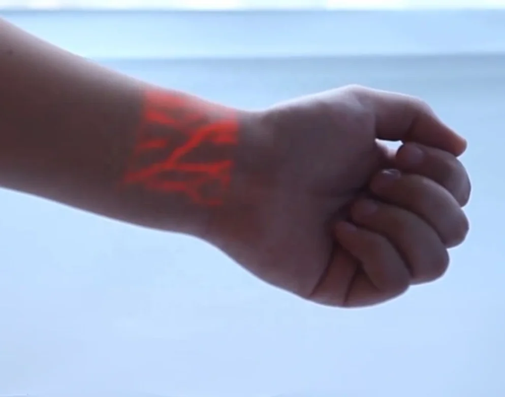 
cheap price US patent Biochemical projecting hospital Veinview 