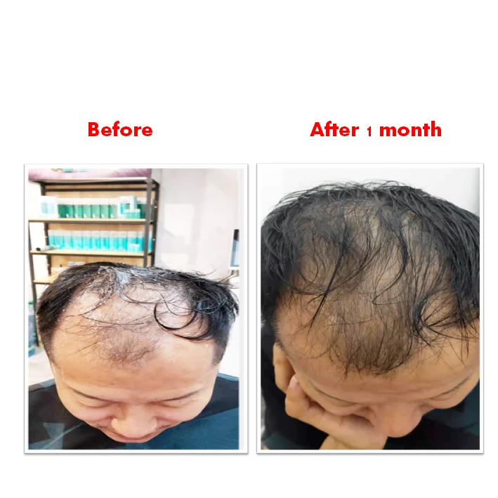 Private label shampoo oil control shampoo For Man shampoo