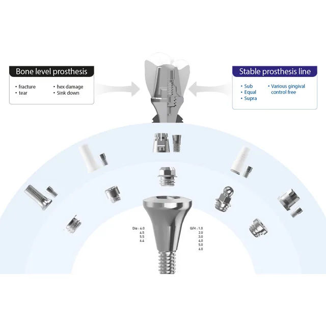 Лидер продаж корейский стабильный абатмент шестигранного типа (SAAH) для стоматологической хирургии цифровой Абатмент