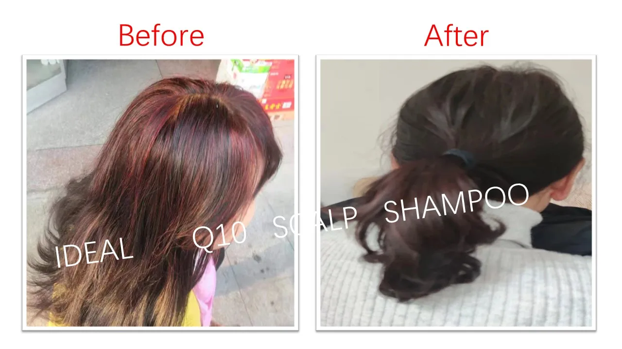 Anti hair loss serum.jpg