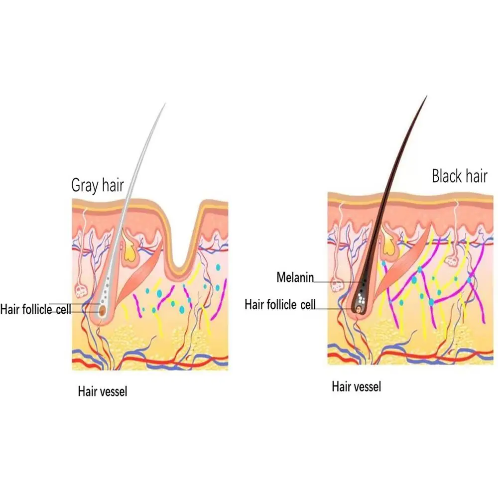 
Private label hair growth serum for Anti Dandruff serum 