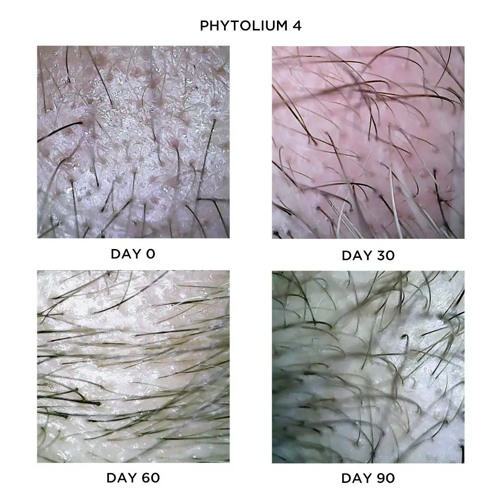 High Quality PHYTO Phytolium 4 Botanical Densifying Scalp Treatment, 12 flasks Readily Available