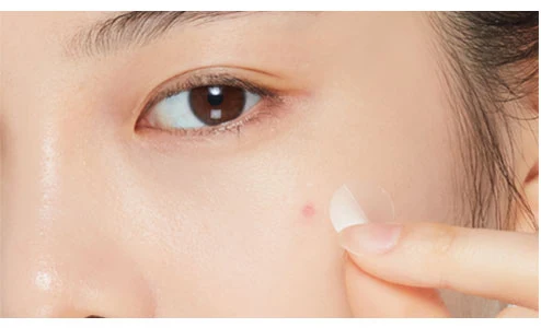 Корейская косметика Amazon лучший этюд домик для очистки от акне патчи пятен 36 штук OEM ODM K beauty