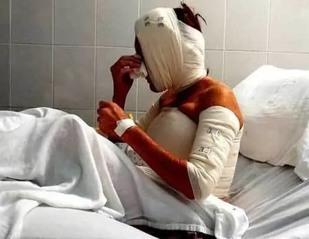 100% Cotton Gauze Bandage Roll With X-Ray