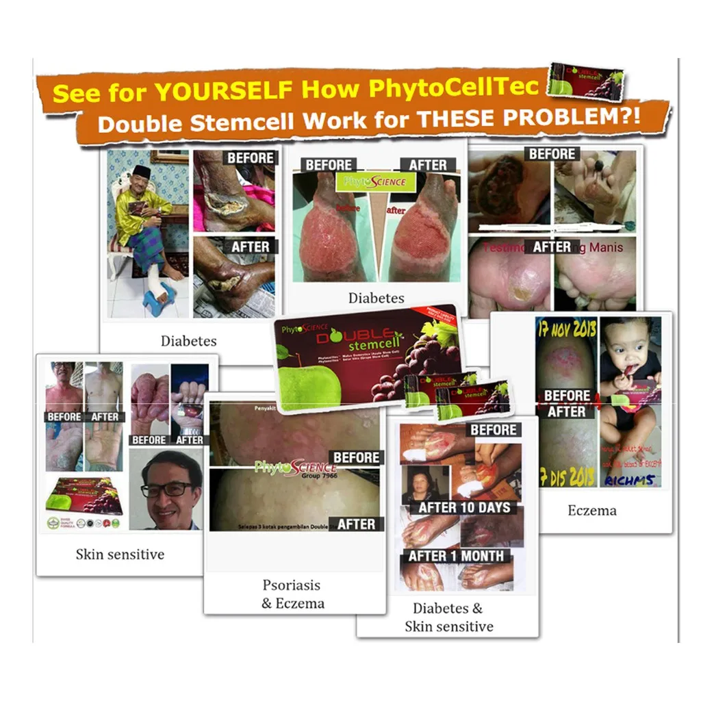 Double Stem Cell Made From Fruits Argan And Grape Size 14 Sachets High Grade Products From Thailand Manufactures