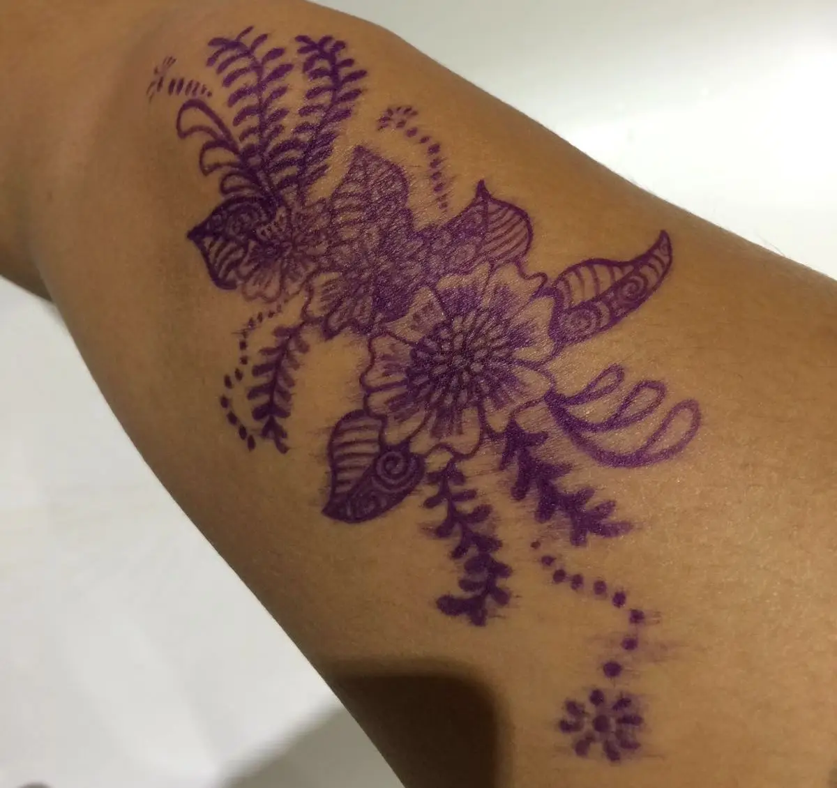 Hot Sale Surgical Skin Marker Surgical Marker Pen With Ruler and 6 labels 0.5Mm Tip