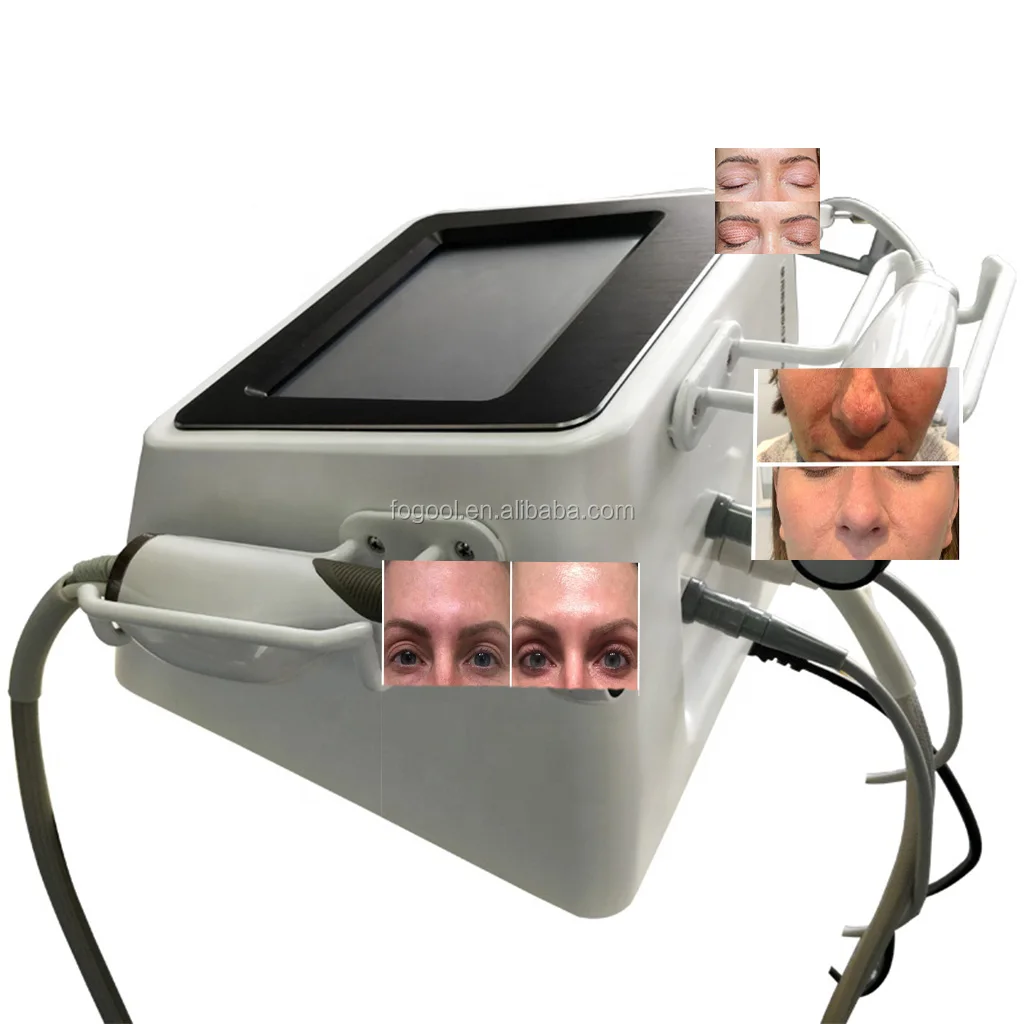 
3 in 1 removing eye bags machines plasma pen device plasma bt 