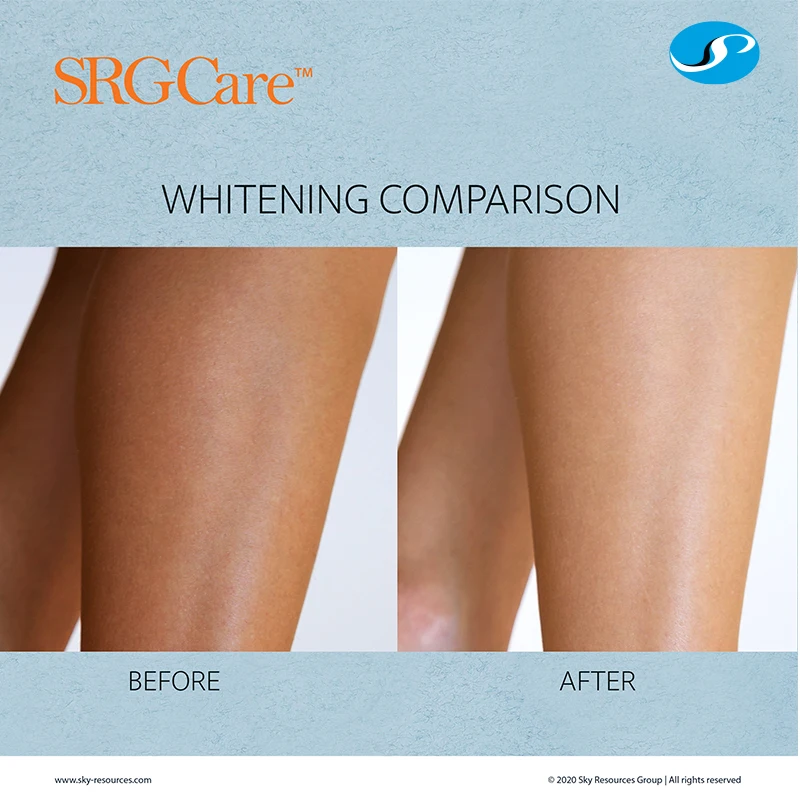 Top Sale Pure Extra Virgin Olive Oil Handmade Herbal Ingredient SRGCare Whitening Luffa Soap Solid Form From Malaysia