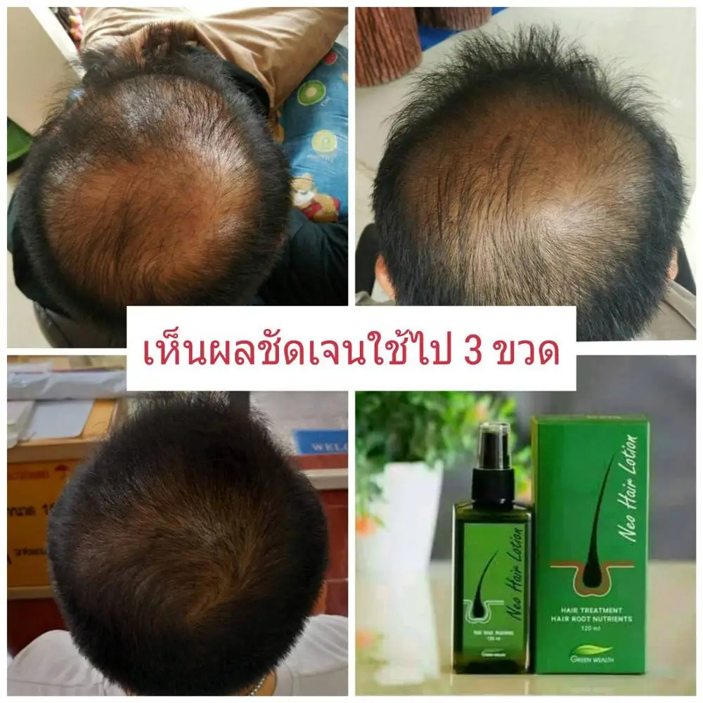 Neo Hair Lotion Hair Root nutrients advanced nutrients