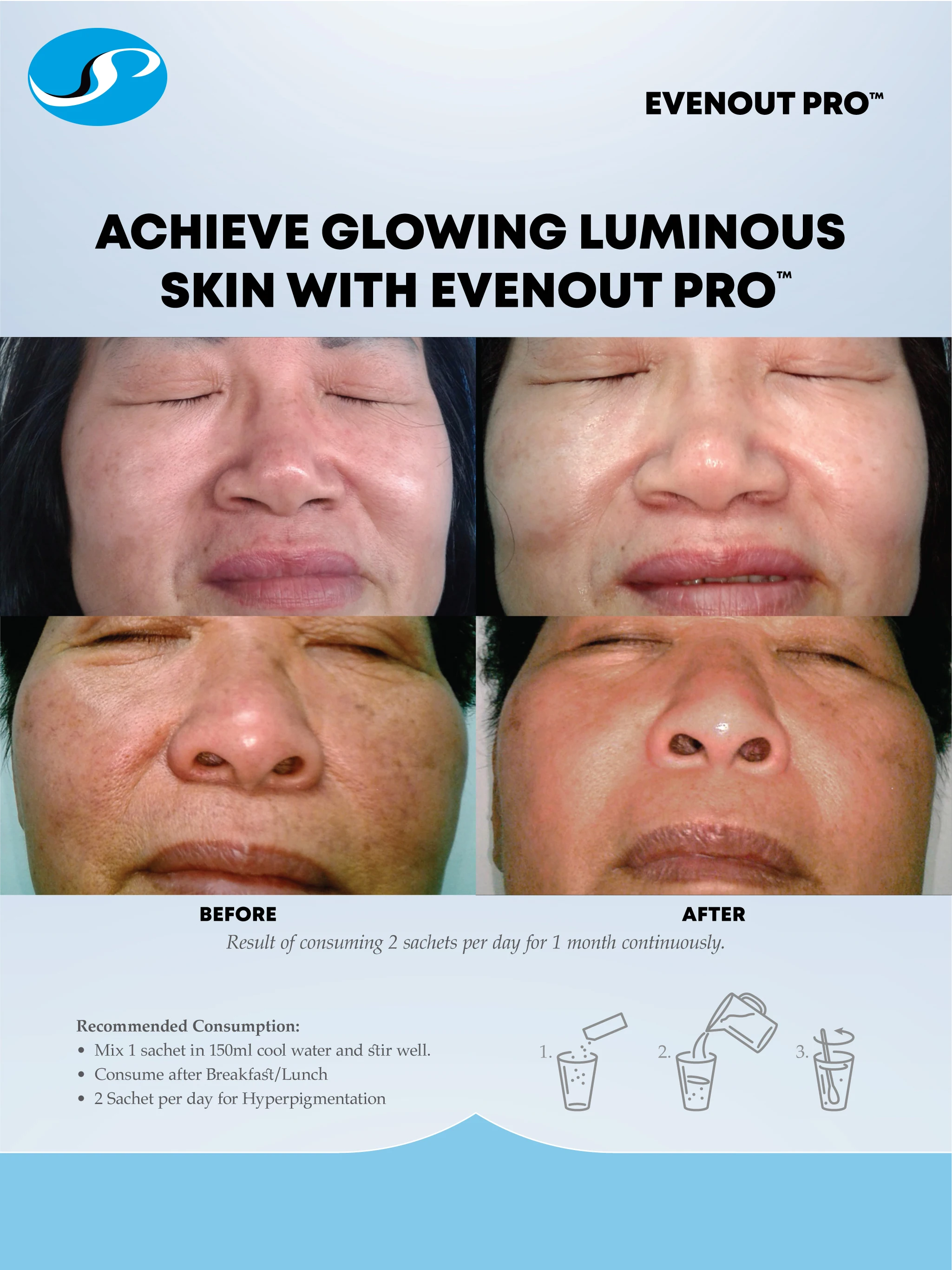 Factory price Nicotinamide Sunscreen supplement repair damage DNA balance uneven skin tone Prevent damage from UV for luminous