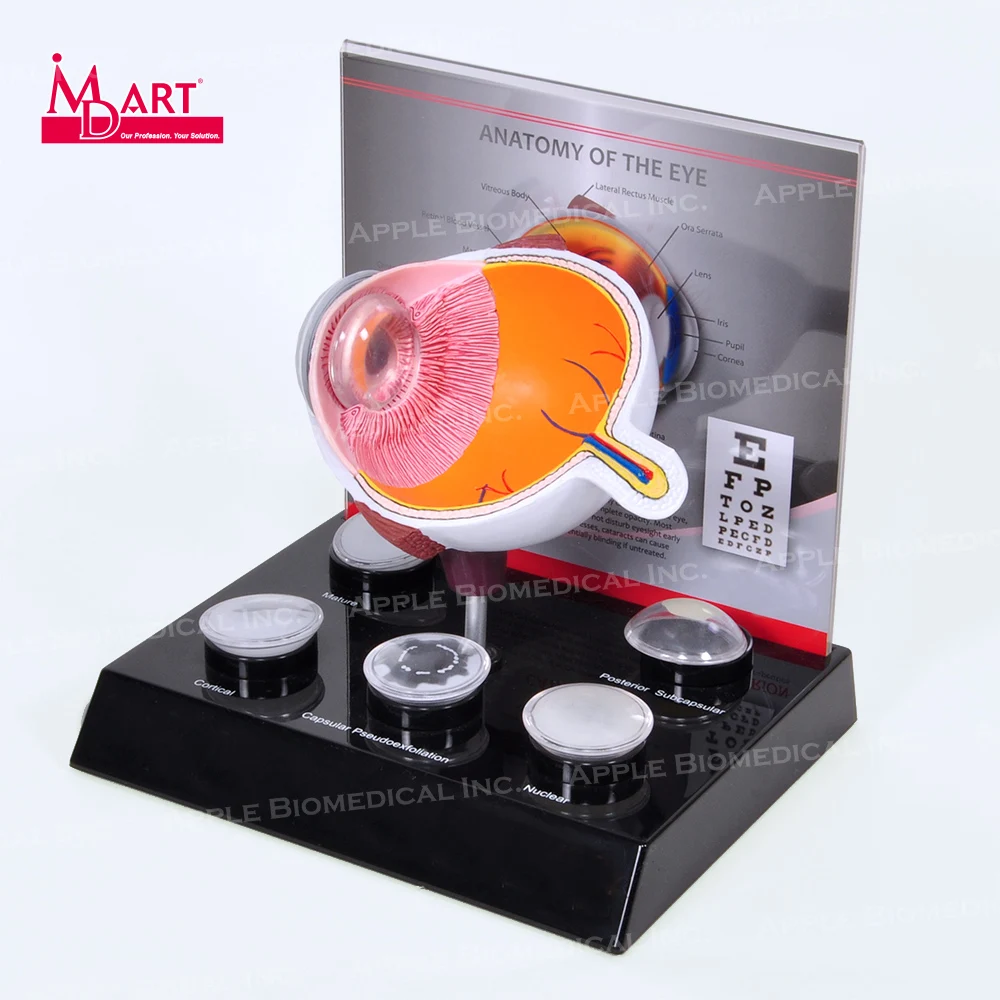 
Human eye model with replaceable disease cataract lens in medical science 