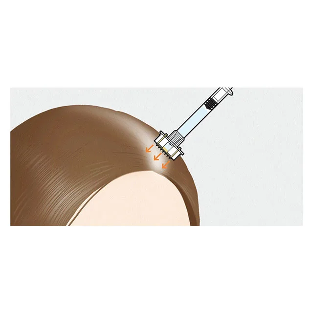  [MITI Systems] Safe and easy to use solid micro needle for hair face from south korea