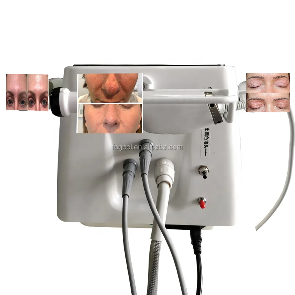 
Plasma fibro shower skin multifunctional beauty keloid wrinkle acen spot removal machine 