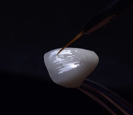 
zirconia crown zirconia teeth zirconia denture 