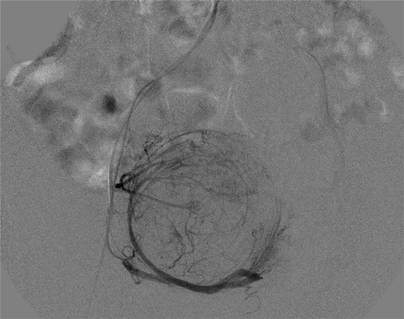 Рентгеновский аппарат O-arm Biotok XR с датчиком плоской панели CMOS 30X30 см рентгеновские интервенционные процедуры Ангиография DSA кардио