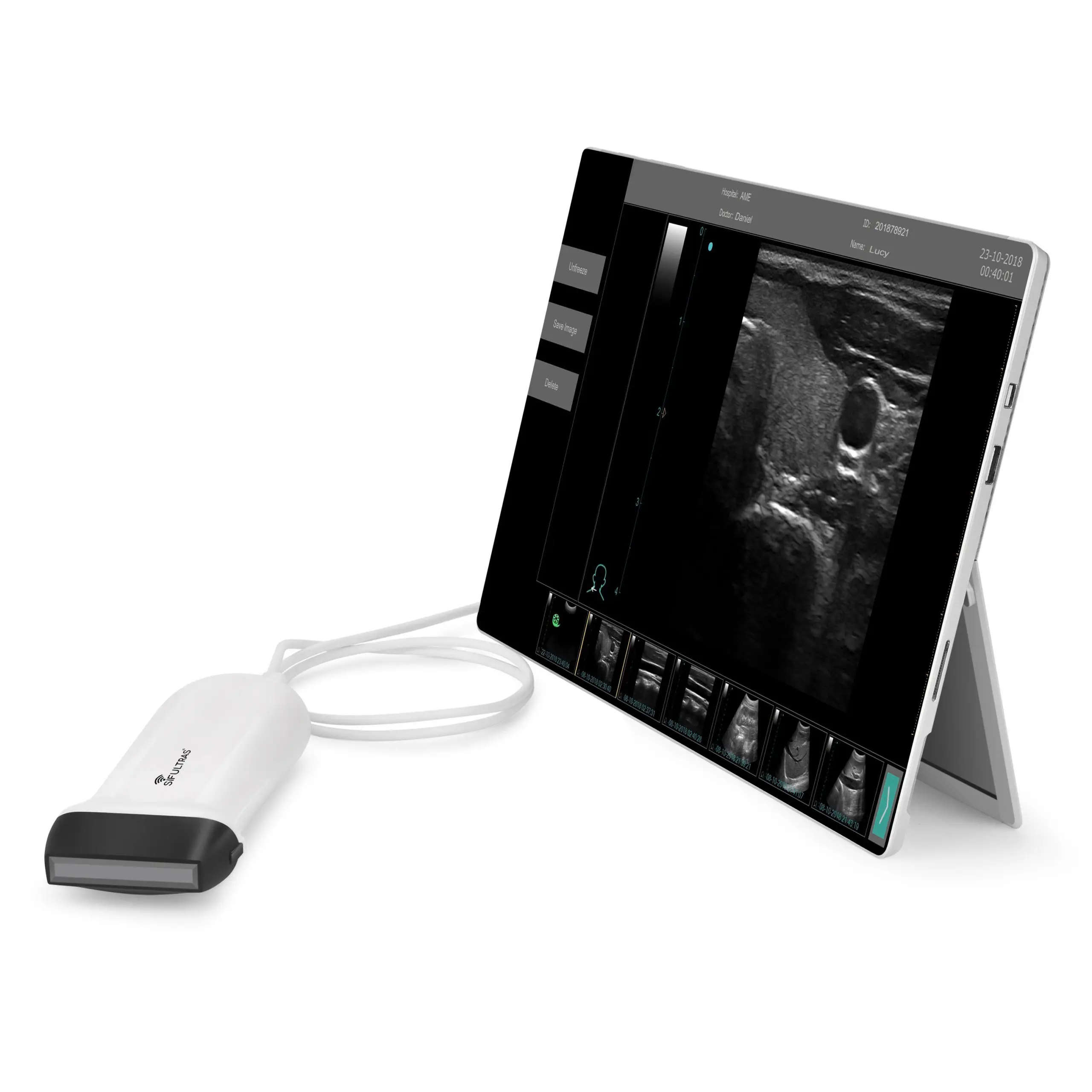 USB Linear 5-12MHz Ultrasound Scanner SIFULTRAS-9.53