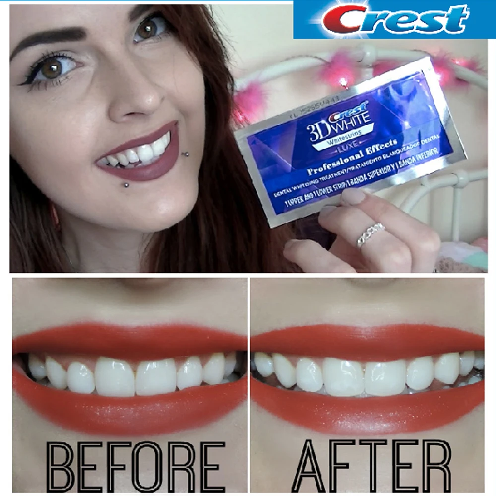 Tiras blanqueadoras Professional Effect whitening strips 20 bolsas 40 tiras para Blanqueamiento de Dientes Tiras blanqueadoras