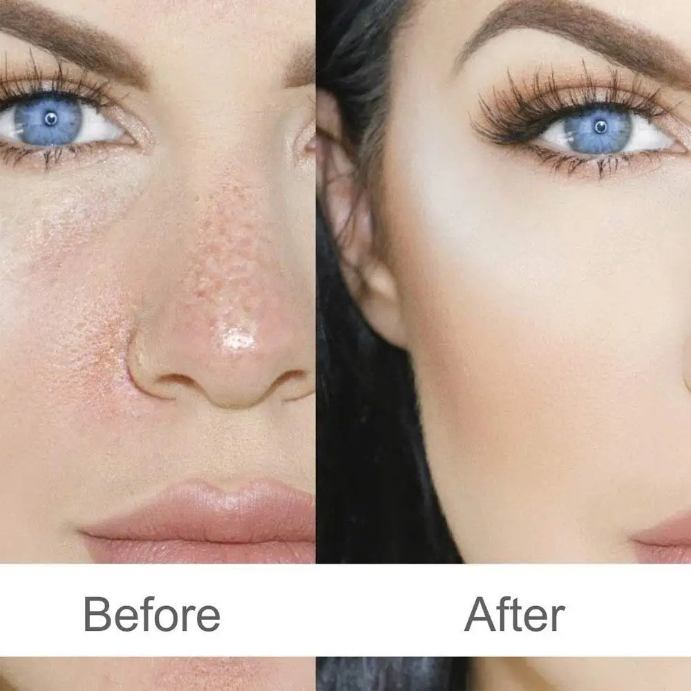  Auravedic kumadi масло без пятен блестящая яркая кожа таиланam 100 мл