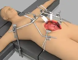 
High Quality Thompson Retractor System Thompson Retractor Complete Set 