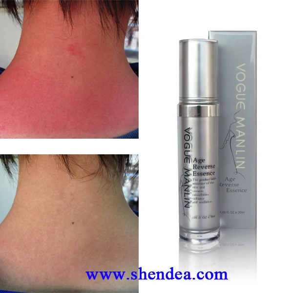 Lifting firming hyaluronic acid instant face lift anti wrinkle moisturizing facial skin moisturizer eye essence anti aging serum