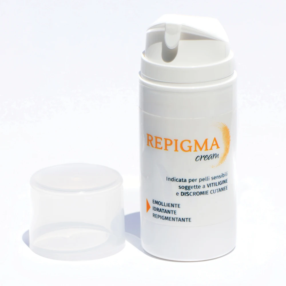 Cream For Vitiligo and Skin Pigmentation Disorders Treatment