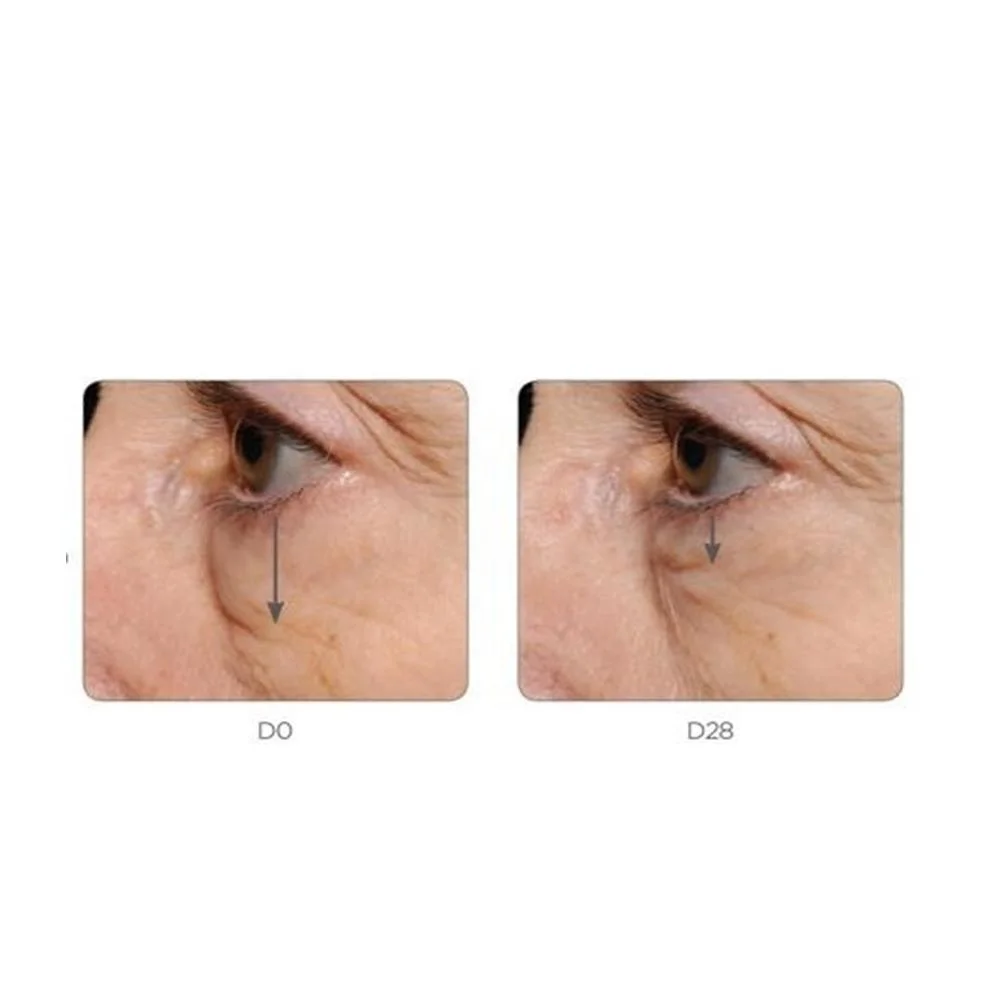 
Anti fine lines eye serum for Private label collagen eye gel 