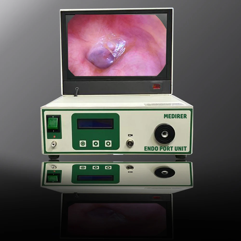 Full HD CCD medical Endoscopy camera and LED light source laparoscope surgery