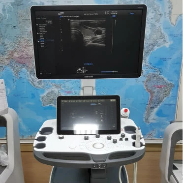 Ультразвук SAMSUNG MEDISON RS80A