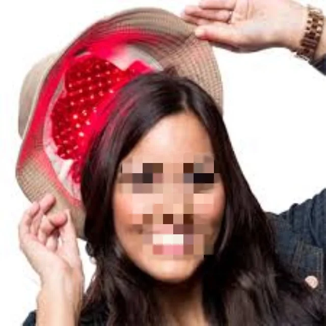 276gen diode laser headach laser cap