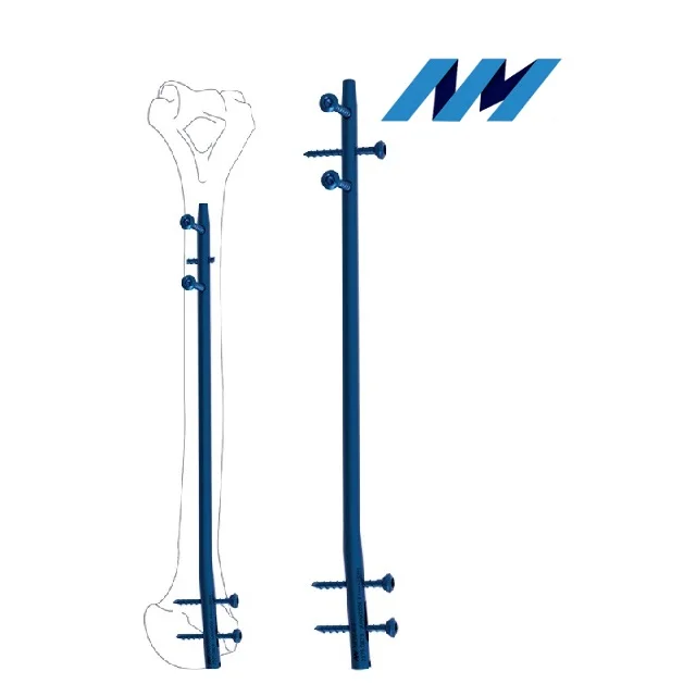 Ортопедический дизайн маникюрного дизайна сцепляющийся титановый гвоздь с ручками Сертификация CE ISO диаметр 6 мм для здоровья и медицинской больницы