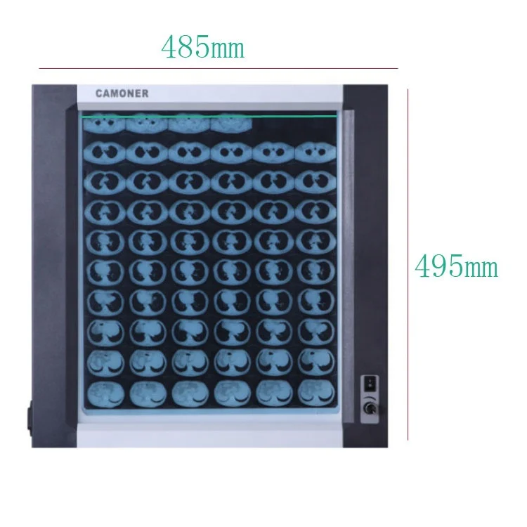 
Medical Single X Ray Film Viewer Double Connections Portable LED X-Ray Film Viewer Triple Illuminator Radiography Negatoscope F 