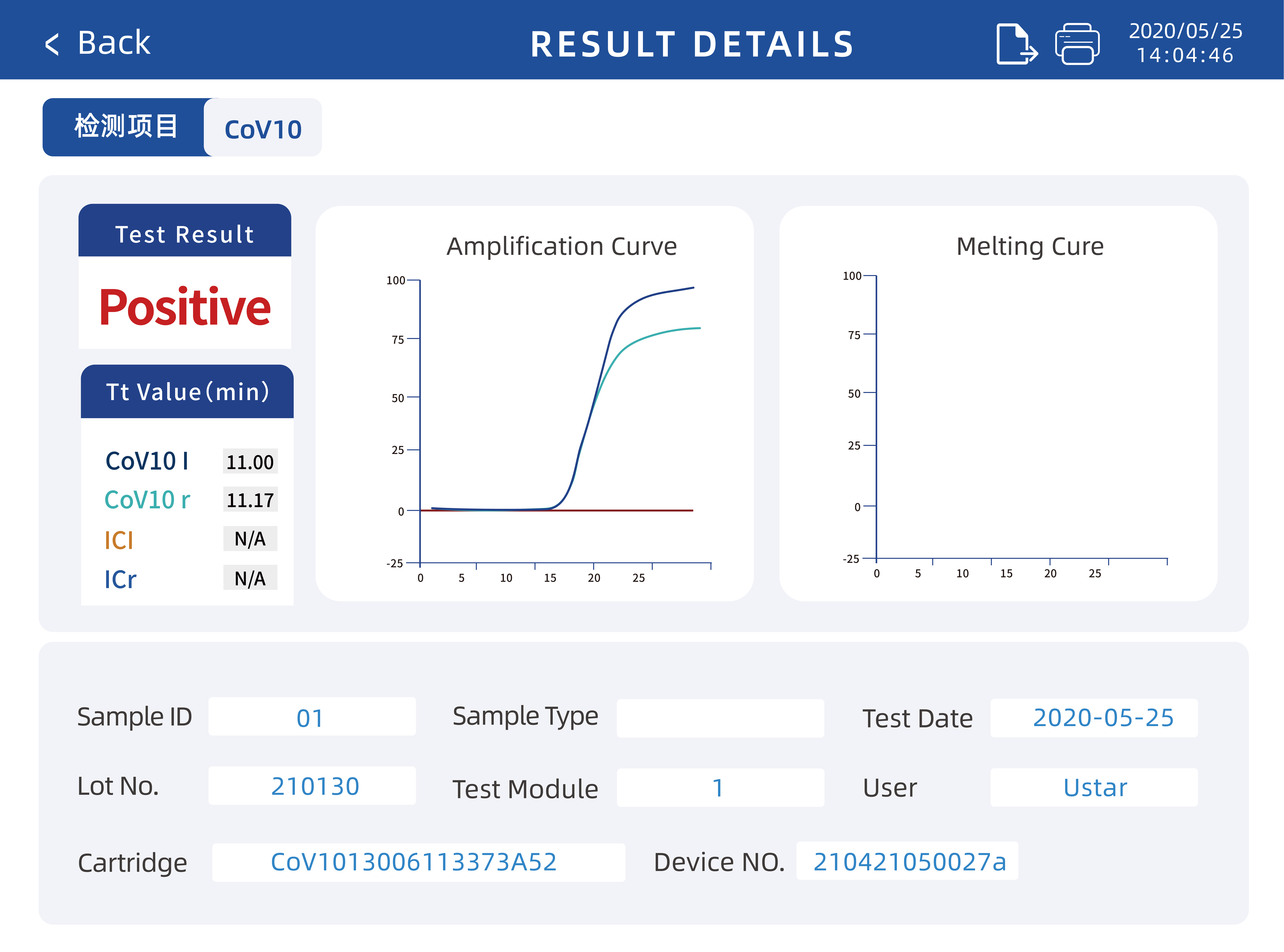 Nucleic Acid Amplification and Detection Analyzer